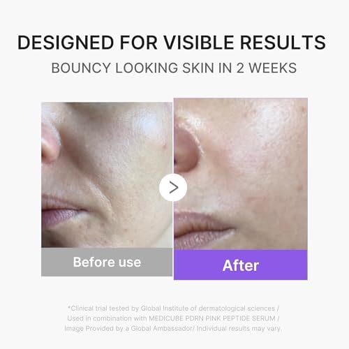 medicube Glass Glow Booster Device Duo | 3-Mode Facial Device for Radiant, Calming, and Bouncy-Looking Skin | Salmon DNA PDRN, Peptides & Niacinamide for Hydration & Firm-Looking Skin, Pink