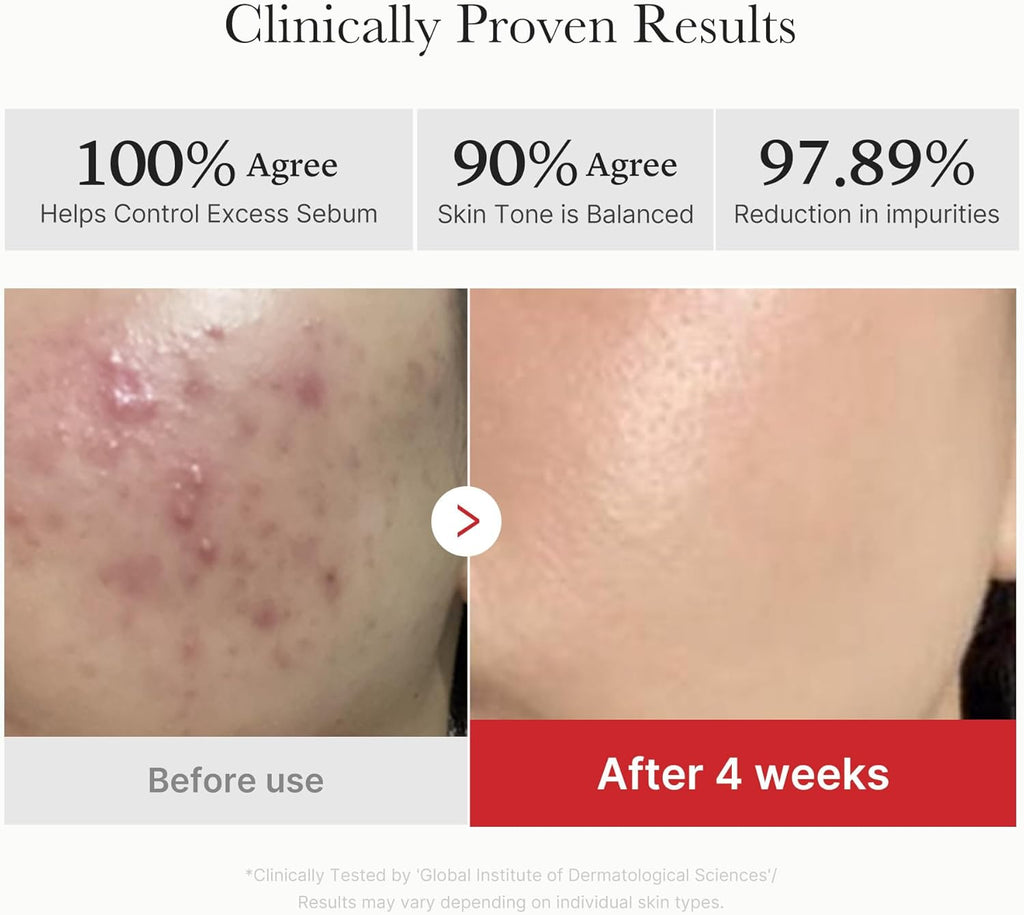 medicube Peel & Swipe Duo: Hypochlorous Acid Rice Peel Shot and Red Succinic Pad for Smooth, Clear Skin | Gentle Exofoliating Duo, Korean Skincare Set