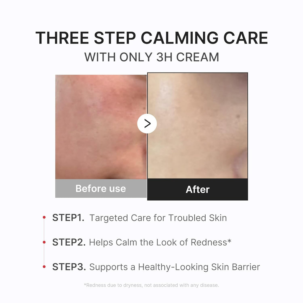 medicube Clear & Calm Skin Duo: Hypochlorous Acid Peel Shot and 3H Relief Cream | Gentle Exfoliating Serum for Dead Skin Cells and Calm with Daily Soothing Moisturizer | For Clearer, Smoother Skin