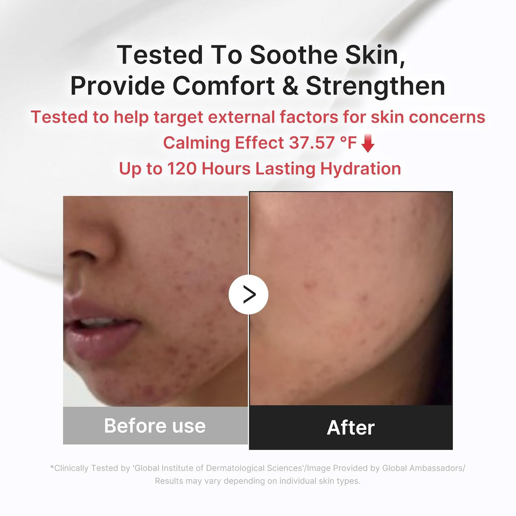 medicube Clear & Calm Skin Duo: Hypochlorous Acid Peel Shot and 3H Relief Cream | Gentle Exfoliating Serum for Dead Skin Cells and Calm with Daily Soothing Moisturizer | For Clearer, Smoother Skin