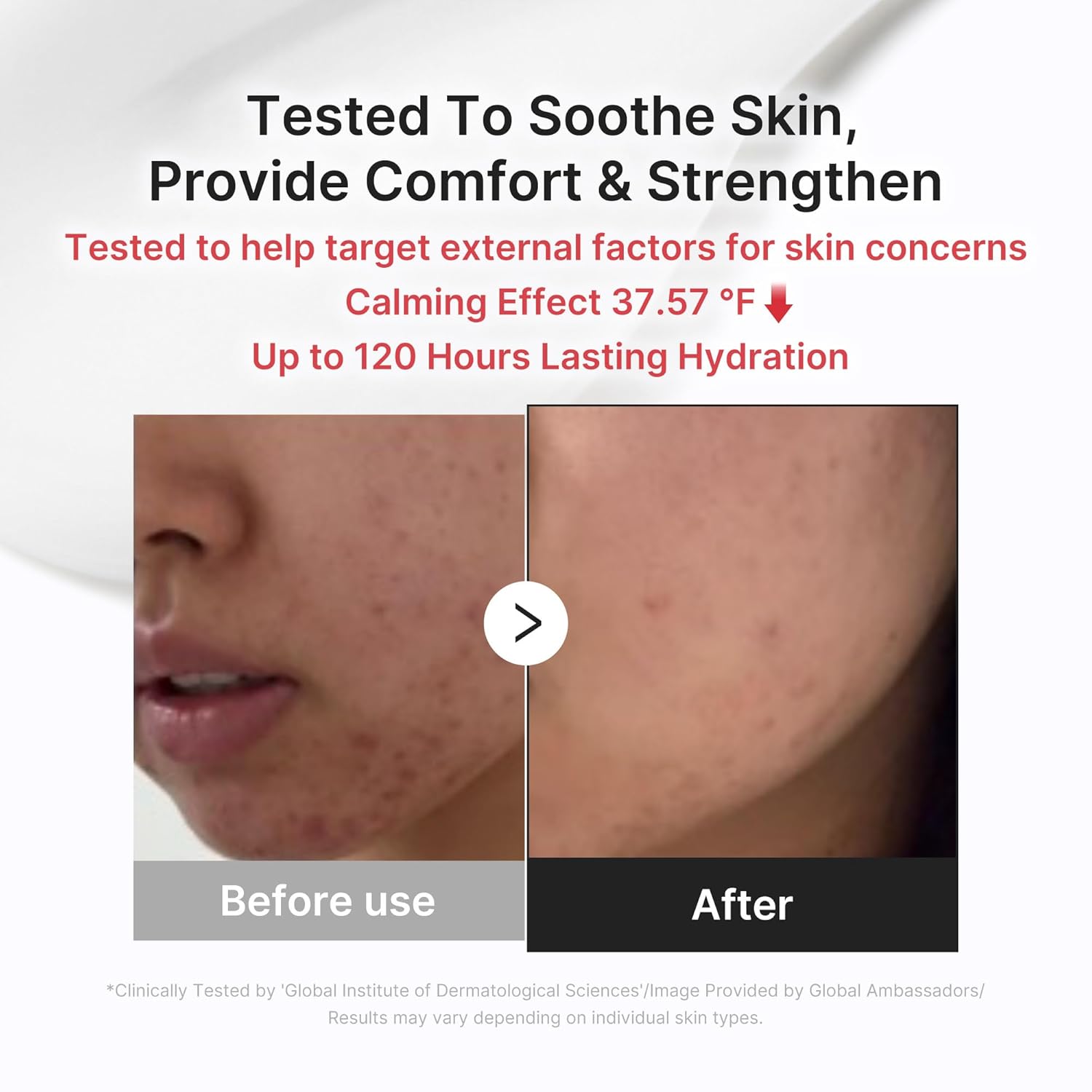 medicube Clear & Calm Skin Duo: Hypochlorous Acid Peel Shot and 3H Relief Cream | Gentle Exfoliating Serum for Dead Skin Cells and Calm with Daily Soothing Moisturizer | For Clearer, Smoother Skin